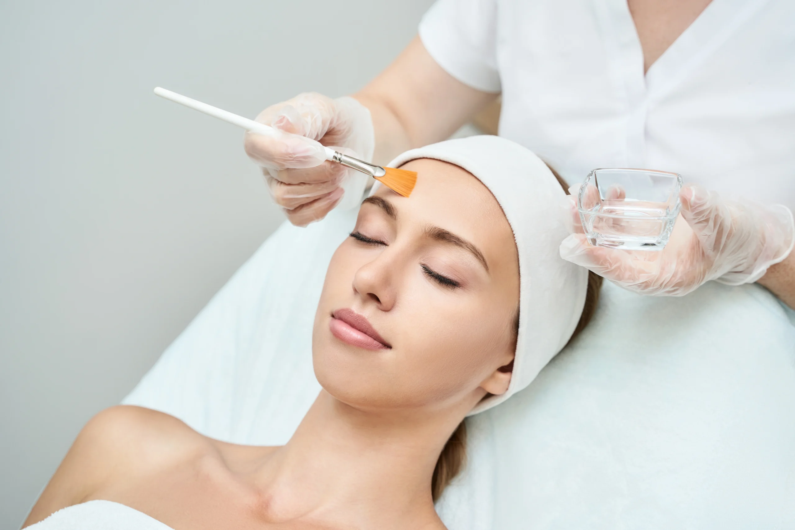 Chemical Peels Treatment by Miramae Studio in Charlotte, NC